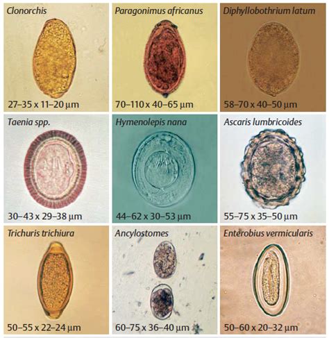  Apicomplexan! A Microscopic Parasite That Lurks Within