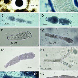  Gregarina:  A Tiny Parasite With A Big Appetite For Insect Guts!