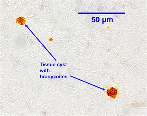  Neospora caninum: Unraveling the Mystery of this Tiny Parasite that Thrives Inside its Host!